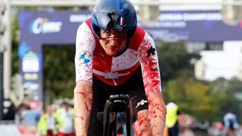 Se cayó de la bicicleta,