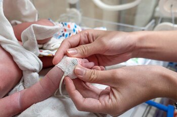 Bebé kogui recibió quemaduras graves