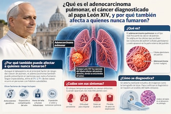 Infografía con el retrato del papa León XIV, un diagrama de pulmones con un tumor, gráficos de síntomas, factores de riesgo y tomografía
