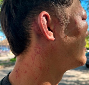 El joven recibió muchos golpes,