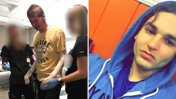 El antes y el después