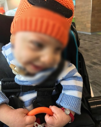 El pequeño también padecía el