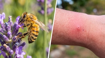 Composición de dos fotos: a la izquierda, una abeja sobre una flor violeta; a la derecha, una muñeca humana con una picadura enrojecida.