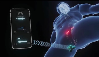 El dispositivo se coloca entre