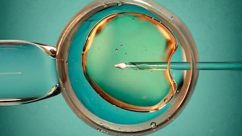 Procedimiento 'añadido' de FIV no funciona, concluye revisión de evidencia