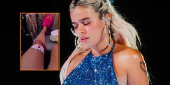 Karol G alarmó a sus