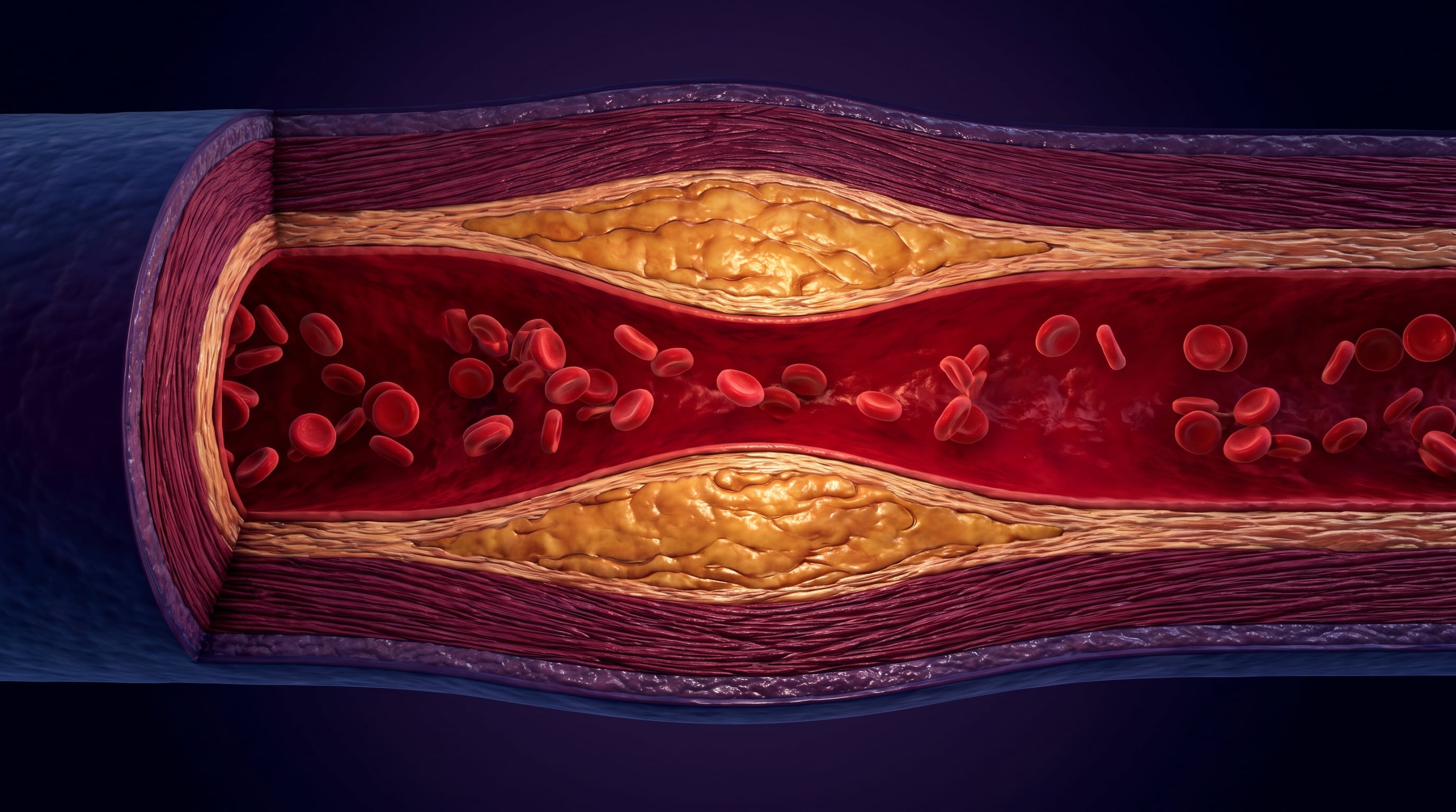 Las enfermedades cardiovasculares causan cerca de 17,9 millones de muertes al año en el mundo, según la Organización Mundial de la Salud. (Imagen Ilustrativa Infobae)