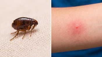 Composición con una pulga sobre tela clara a la izquierda y una picadura rojiza en el brazo de una persona a la derecha.