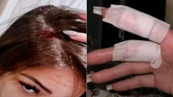 Las pruebas que presentó a