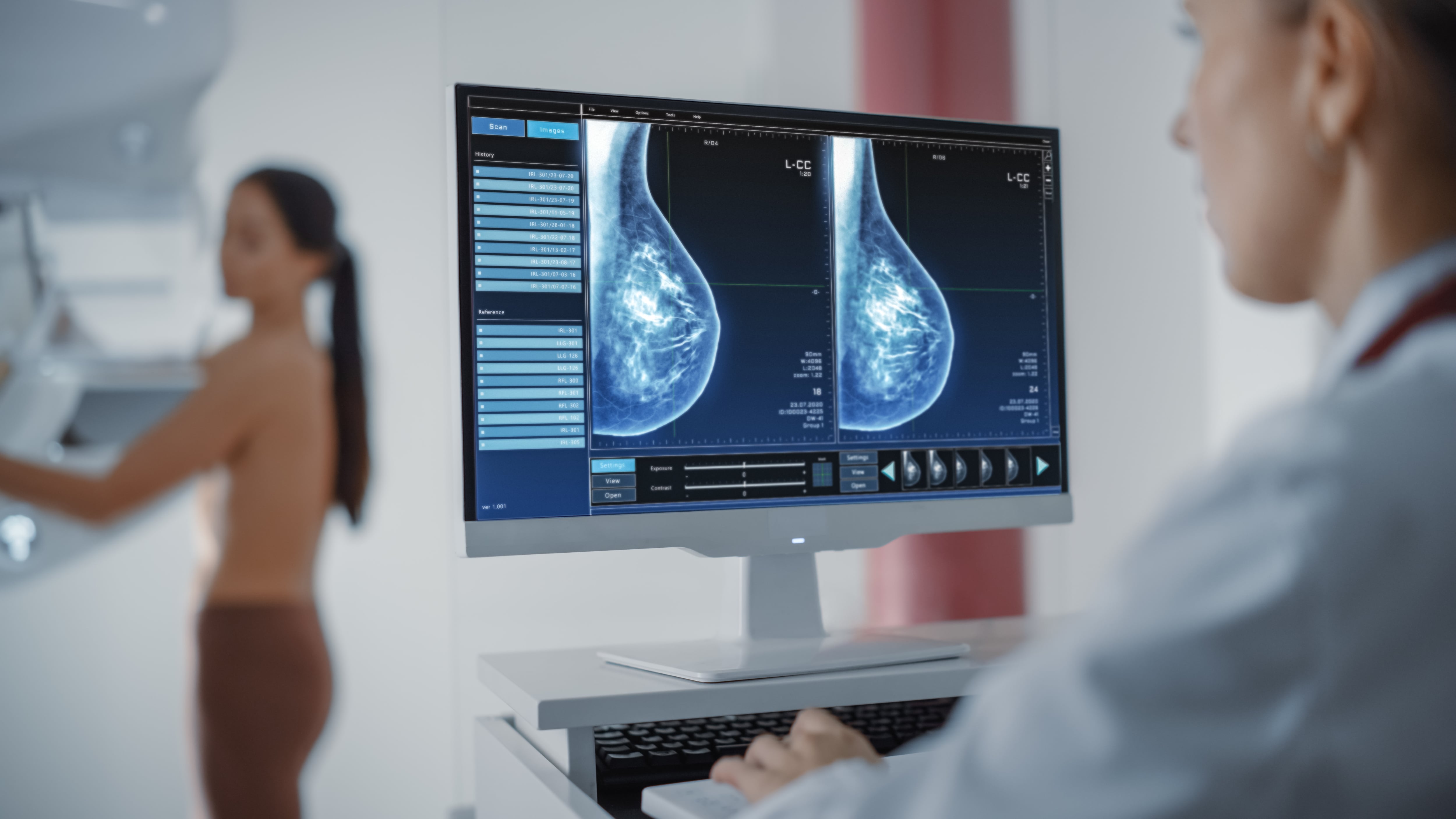 El cáncer de mama afecta a una de cada ocho mujeres en El Salvador, según datos del Ministerio de Salud. (Foto cortesía)