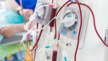 Nacer prematuro está relacionado con daños de por vida en el empleo y la educación - Infobae