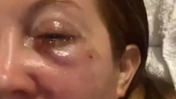 Así le quedó la cara