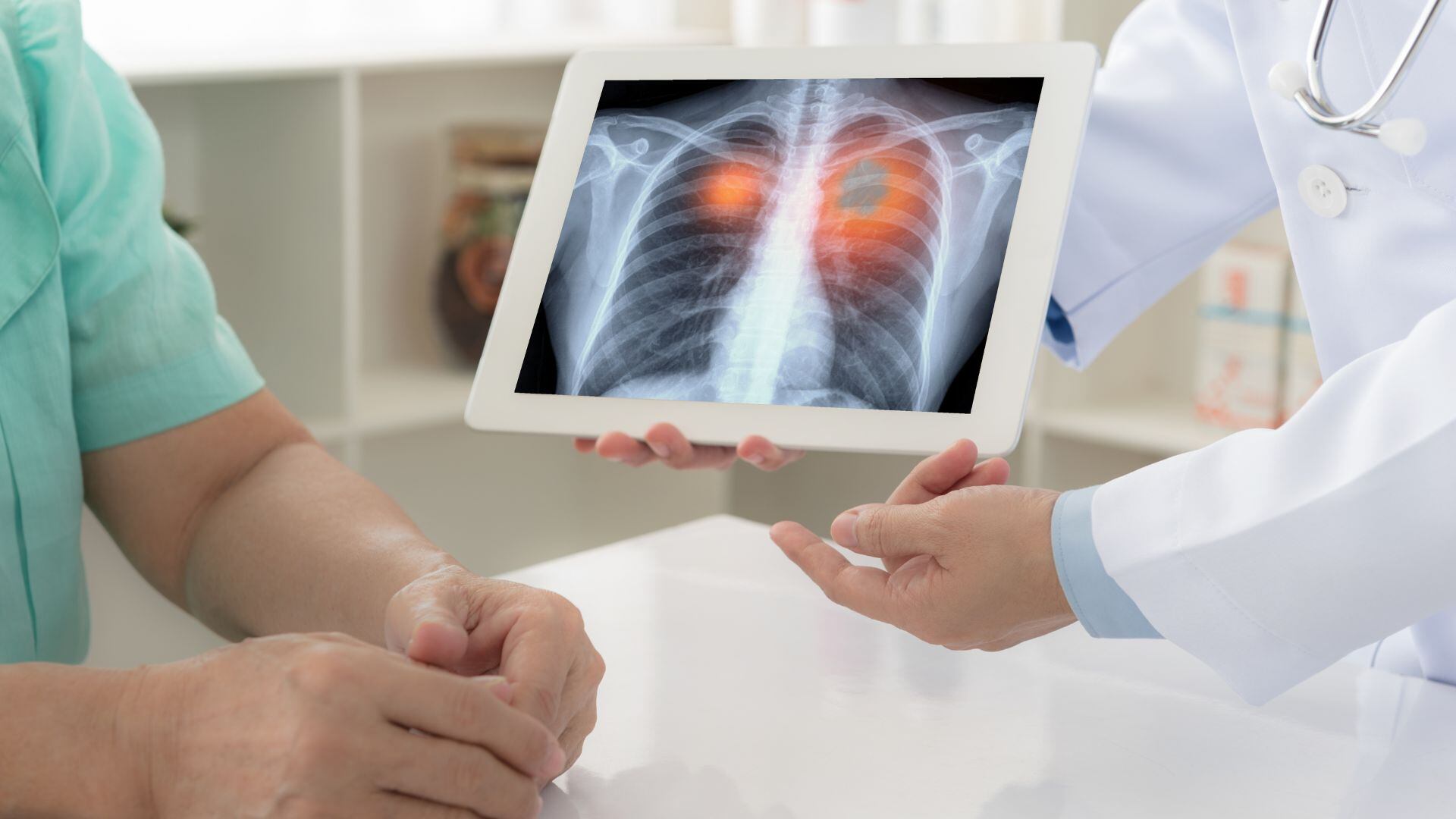 Un doctor muestra una prueba hospitalaria sobre los pulmones. (Canva)