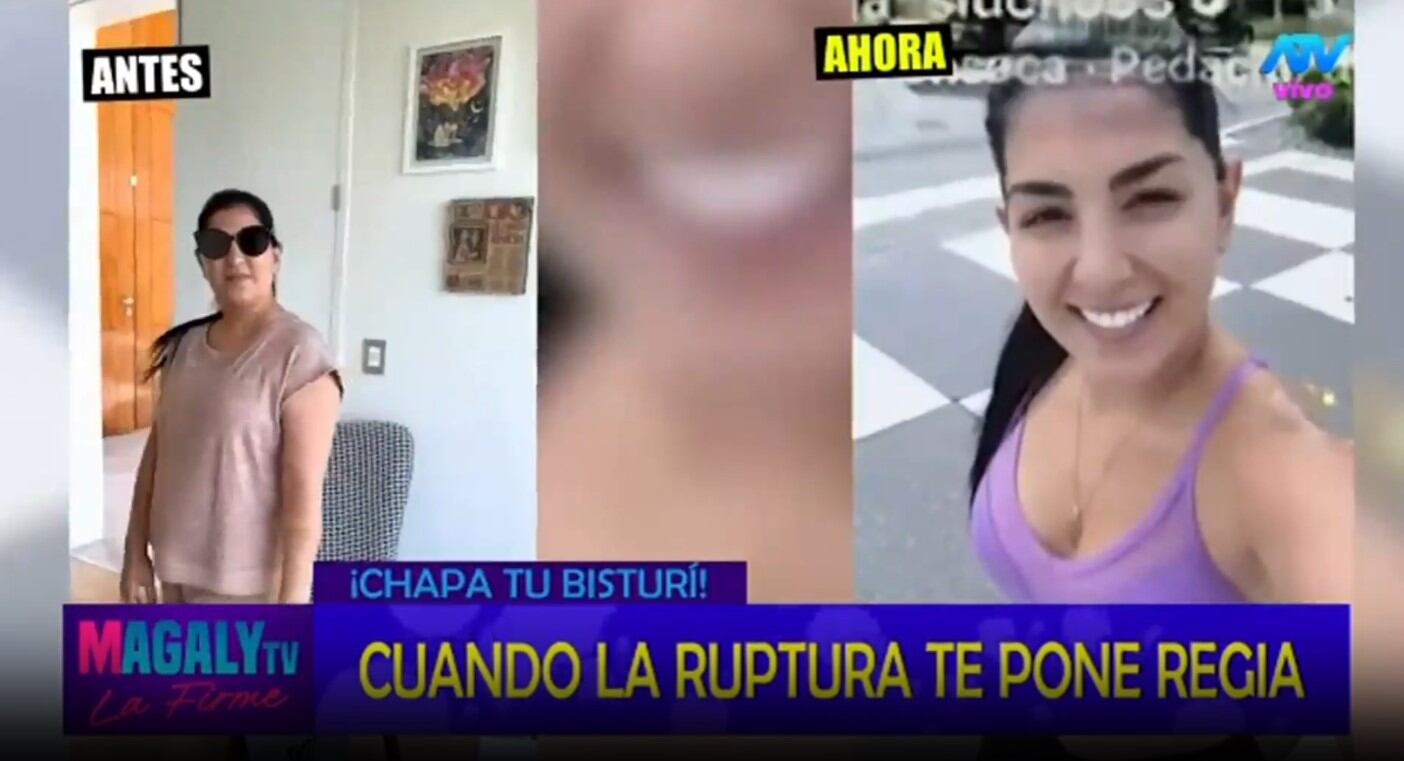 Magaly Medina reflexiona sobre el poder de la cirugía estética tras una ruptura: “El cambio físico puede elevar la autoestima”. Infobae Perú / Captura TV - Magaly TV La Firme