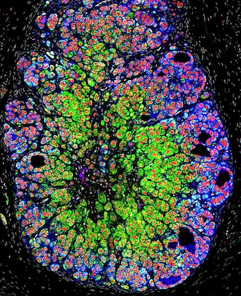 Científicos en Filadelfia lograron crear una mini glándula suprarrenal humana funcional en una placa de Petri (Michinori Mayama, Universidad de Pensilvania)