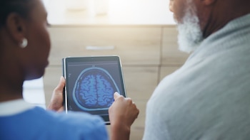 Resultados alentadores con medicamento para el Alzheimer, según un estudio