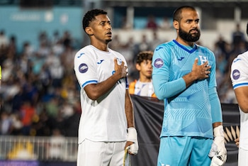 Las molestias físicas condicionaron la continuidad y el rendimiento del futbolista durante su estadía en Santos Laguna. (Cortesía: Instagram Choco Lozano)