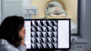 Por qué el cáncer de