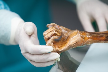 Hombre de Hielo Ötzi