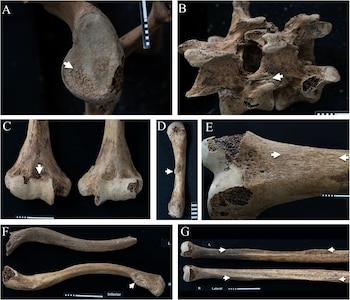 Siete imágenes de huesos humanos con detalles de superficie, algunas con flechas blancas, letras identificatorias de A a G y escalas de medición sobre fondo oscuro