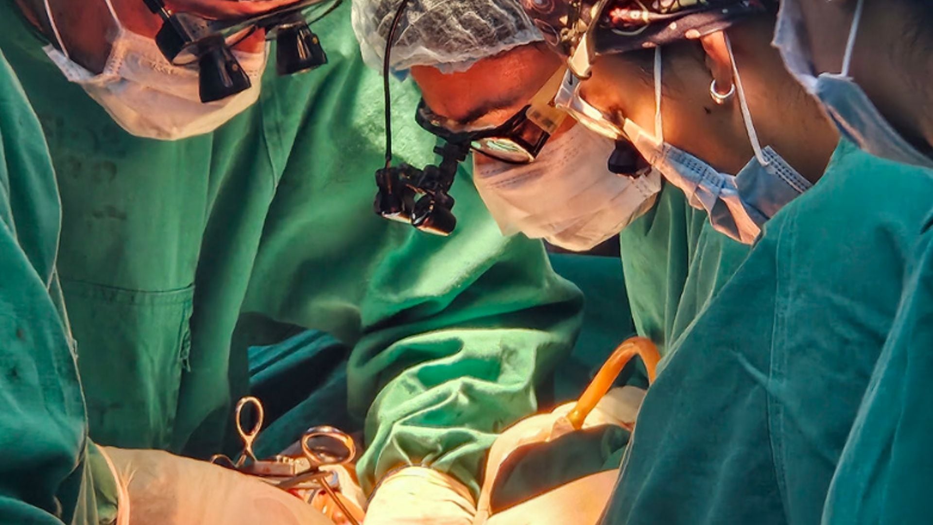 La Ley Justina presume la voluntad afirmativa para donar órganos en mayores de 18 años y aceleró los procesos de ablación y trasplante (Pexel)