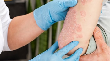 El diagnóstico temprano de la