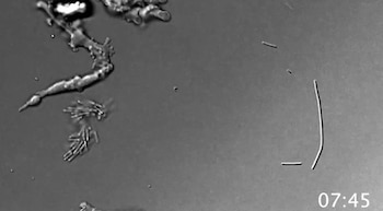 Imagen en escala de grises de bacterias y filamentos microscópicos con una marca de tiempo que indica 07:45