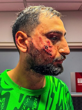 Donnarumma en acción