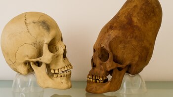 Muerte violenta o accidente: el