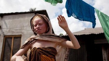 Amnistía Internacional instó a los