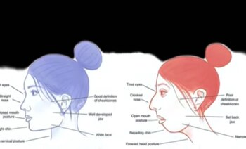 El cambio que puede sufrir