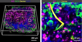 Representación tridimensional de imágenes de