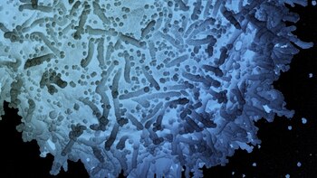 ¿Es posible predecir los casos