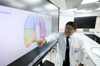 Cáncer al pulmón en Perú
