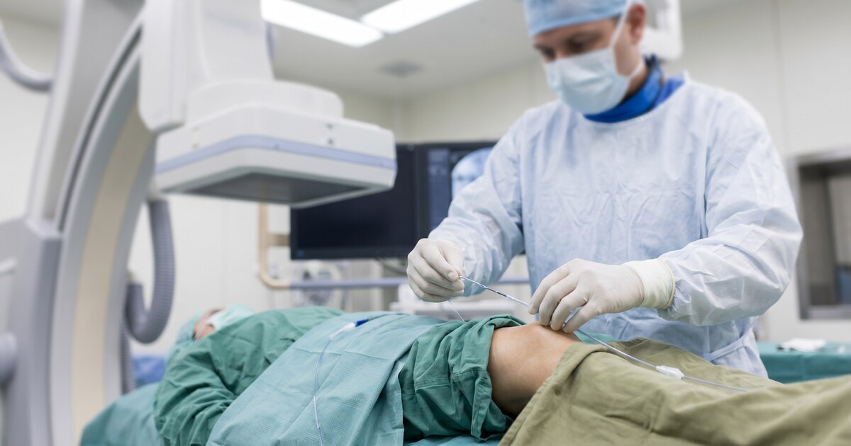 Nueva técnica mínimamente invasiva reduce el dolor de la artrosis de rodilla sin cirugía