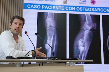 El cirujano del Hospital Gregorio Marañón, Rubén Pérez Mañanes durante la presentación de la primera prótesis personalizada en el mundo. (EFE/ Mariscal)