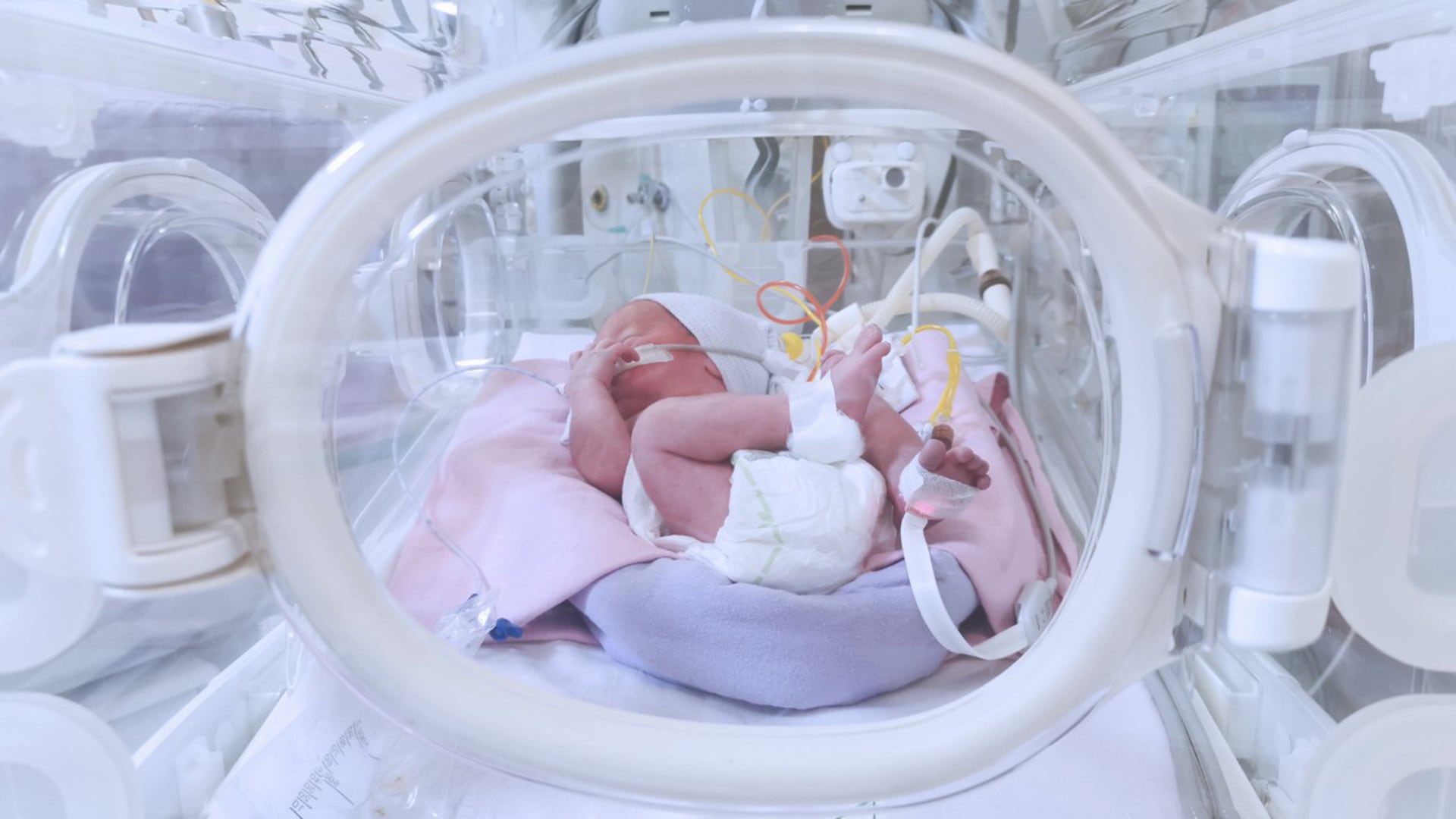 El riesgo de desarrollar displasia varía según la cantidad de oxígeno que necesita cada bebé (UNSAM)