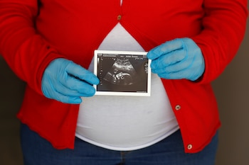 Los obstetras de todo el