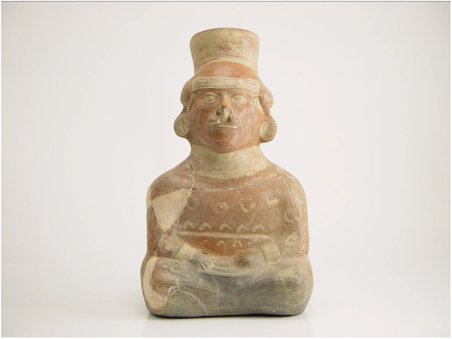 El análisis osteológico confirmó la presencia de labio hendido y paladar hendido en un joven adulto masculino de la cultura Paracas - Scaffidi, BK (2025). ¿Celebrando el labio leporino? Evidencia osteológica y artística de la deformidad labial en un individuo con cabeza de trofeo del sur del Perú. Ñawpa Pacha , 1–25. https://doi.org/10.1080/00776297.2025.2565062