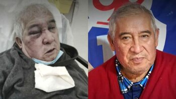 Guillermo Oyarzún perdió el sentido