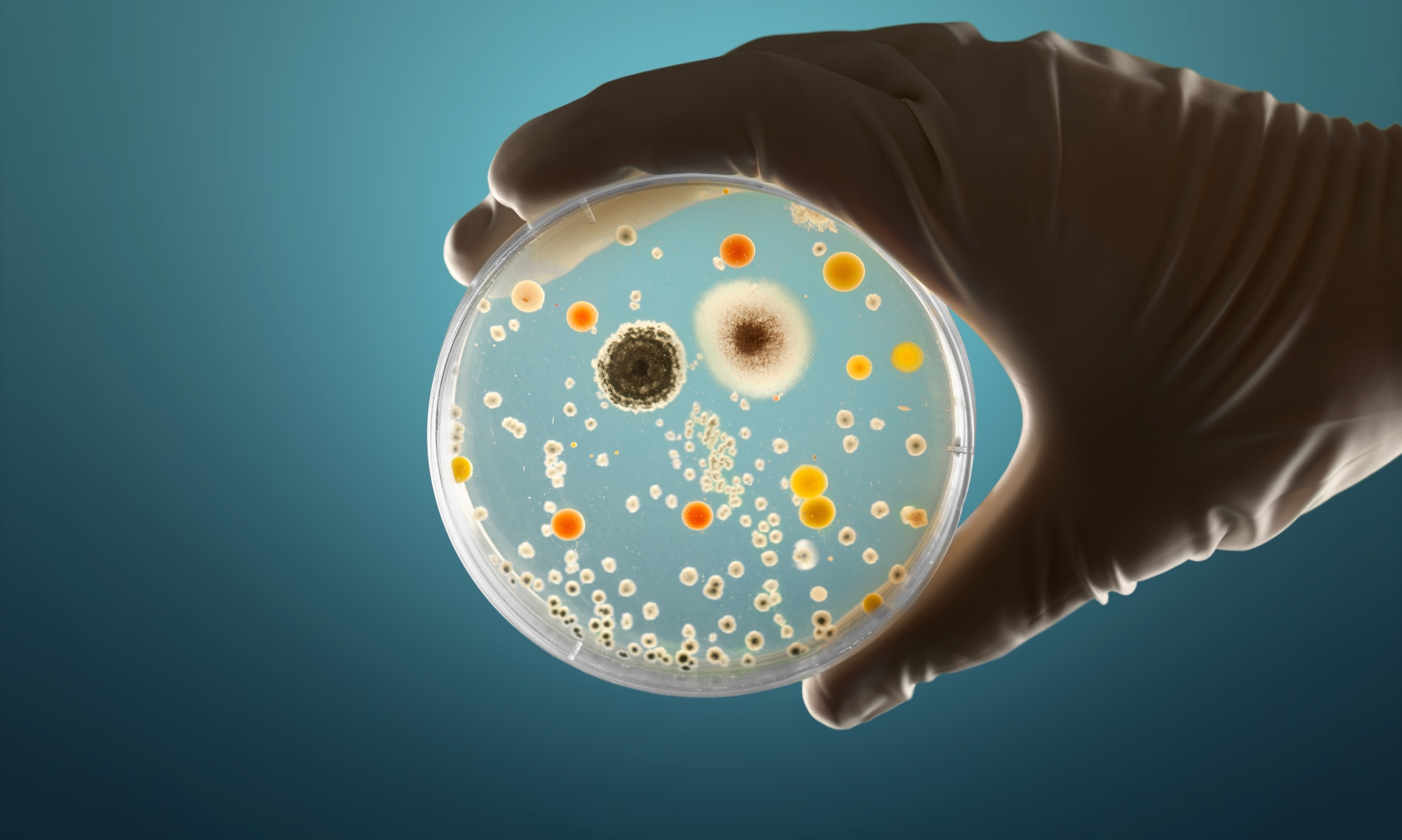 Una placa Petri con colonias de microorganismos. (Adobe Stock)