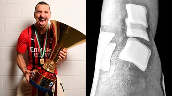 Zlatan Ibrahimovic contó el calvario