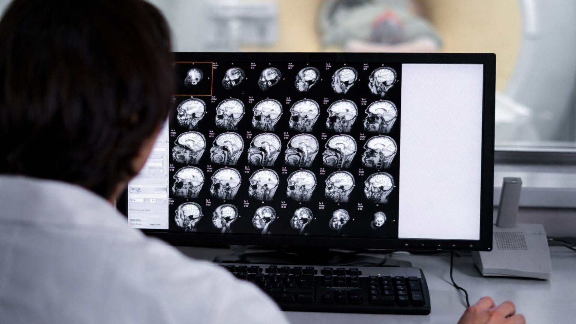 Estudiante con esclerosis múltiple pide al presidente de Perú y al ministro de salud acelerar acceso a medicamentos para enfermedades raras.