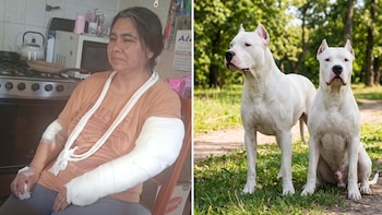 Dramático relato de la mujer que fue atacada por dos dogos en Trelew: “Solo rogaba que no me mataran”