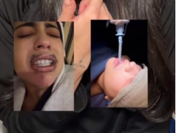 La mujer denuncia inyección de silicona con aceite industrial en sus labios