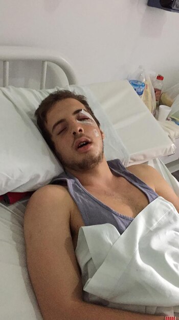 A pesar que a simple