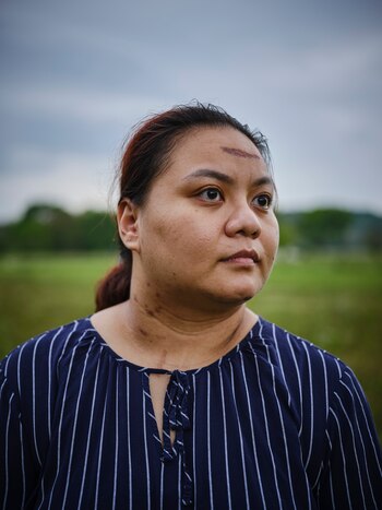 Kim Victory padeció alucinaciones paranoides.