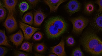 Vista de microscopio que muestra múltiples células humanas con núcleos de color azul brillante, rodeadas por un citoplasma rojizo y filamentos verdes entrelazados sobre un fondo oscuro.