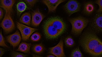 El secreto de las máquinas moleculares celulares: clave para entender el cáncer y la neurodegeneración