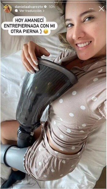 Álvarez lució orgullosa sus prótesis,